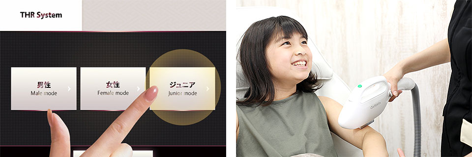 脱毛 ジュニアモード